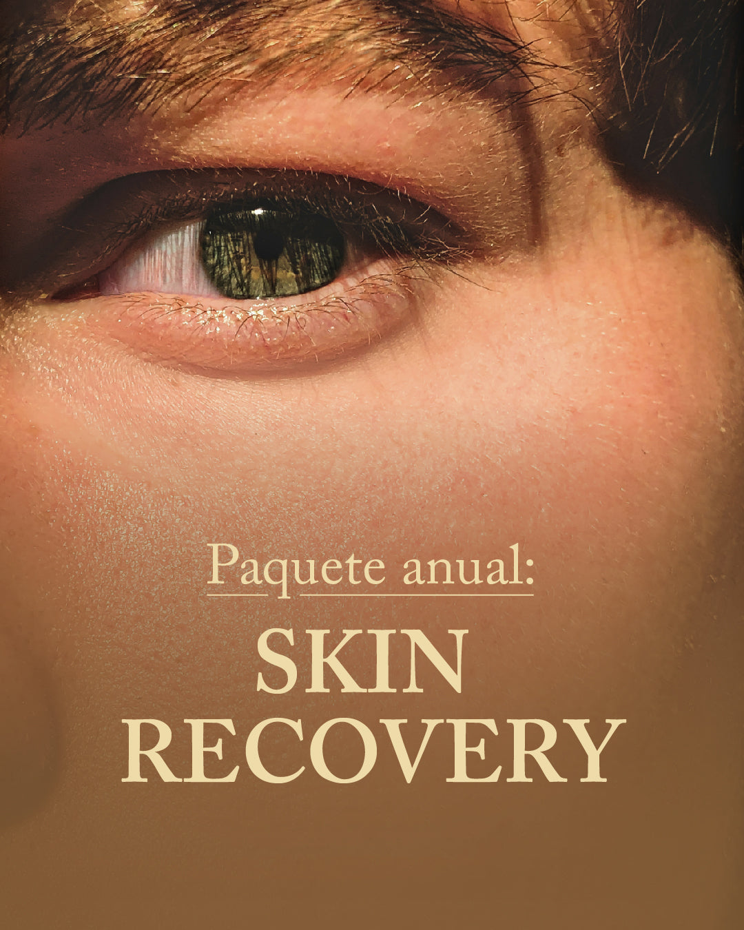 Sculptra + Toxina botulínica + Hidratación profunda
