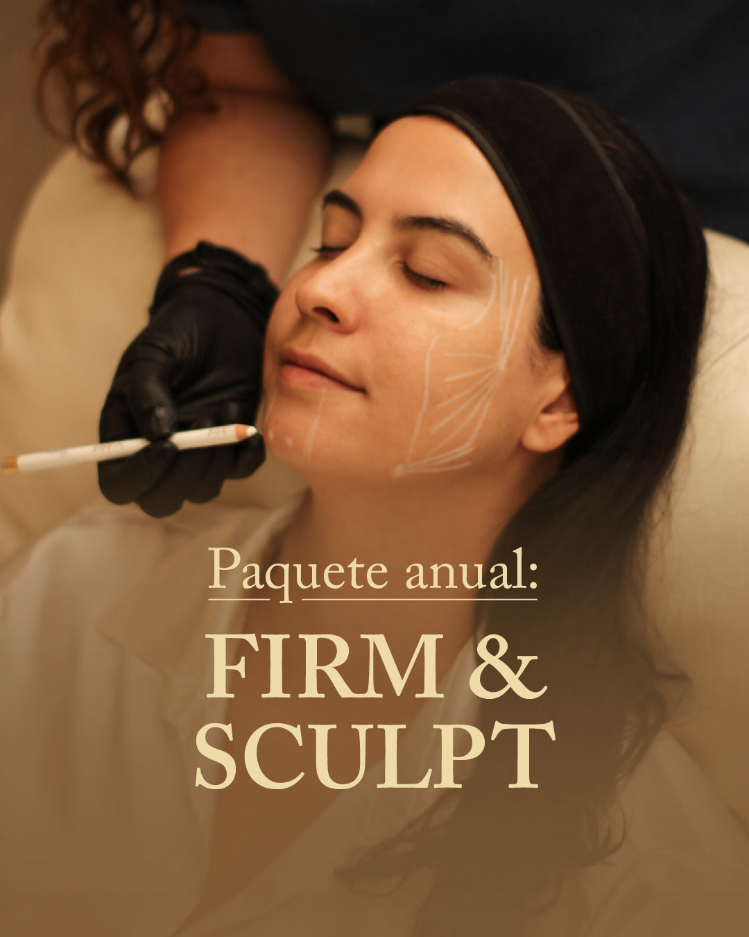 Sculptra + Toxina botulínica + Hidratación con Skinbooster